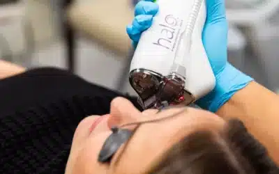 Why Laser Season in Charleston Means Your Skin Needs Extra Care