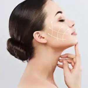 Sculptra