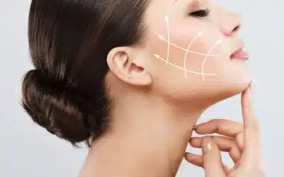 Bio-Stimulators 101: Sculptra & Radiesse Explained